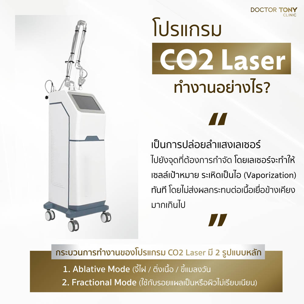 co2 laser ทำงานอย่างไร?