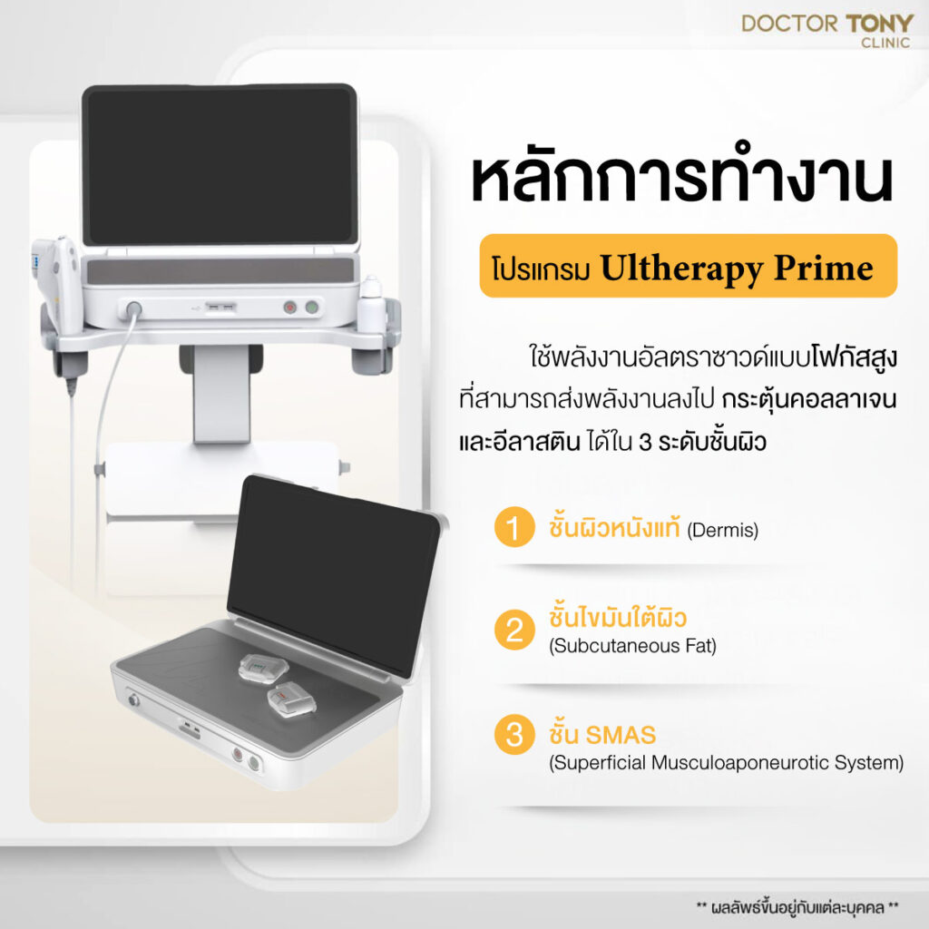 ulthera prime ทำงานอย่างไร?
