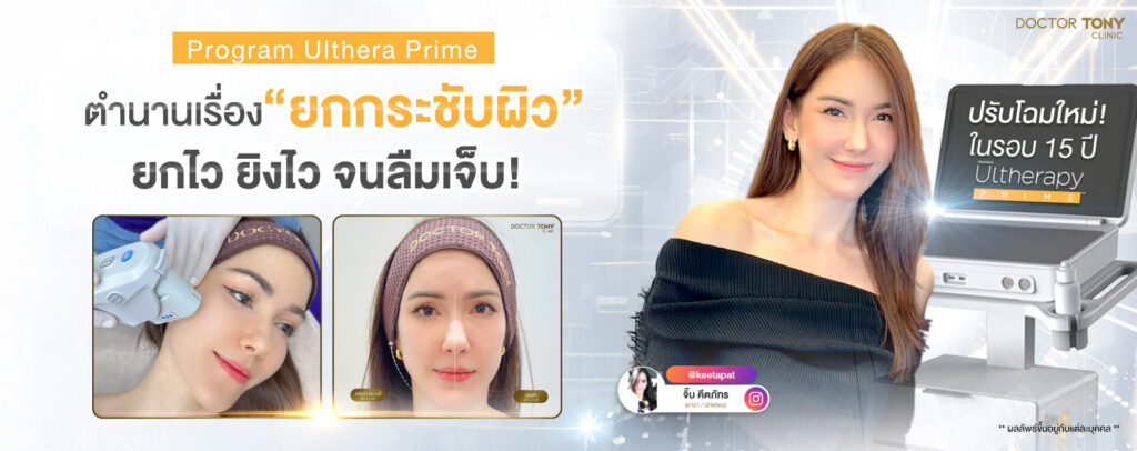 ulthera prime ยกกระชับผิว