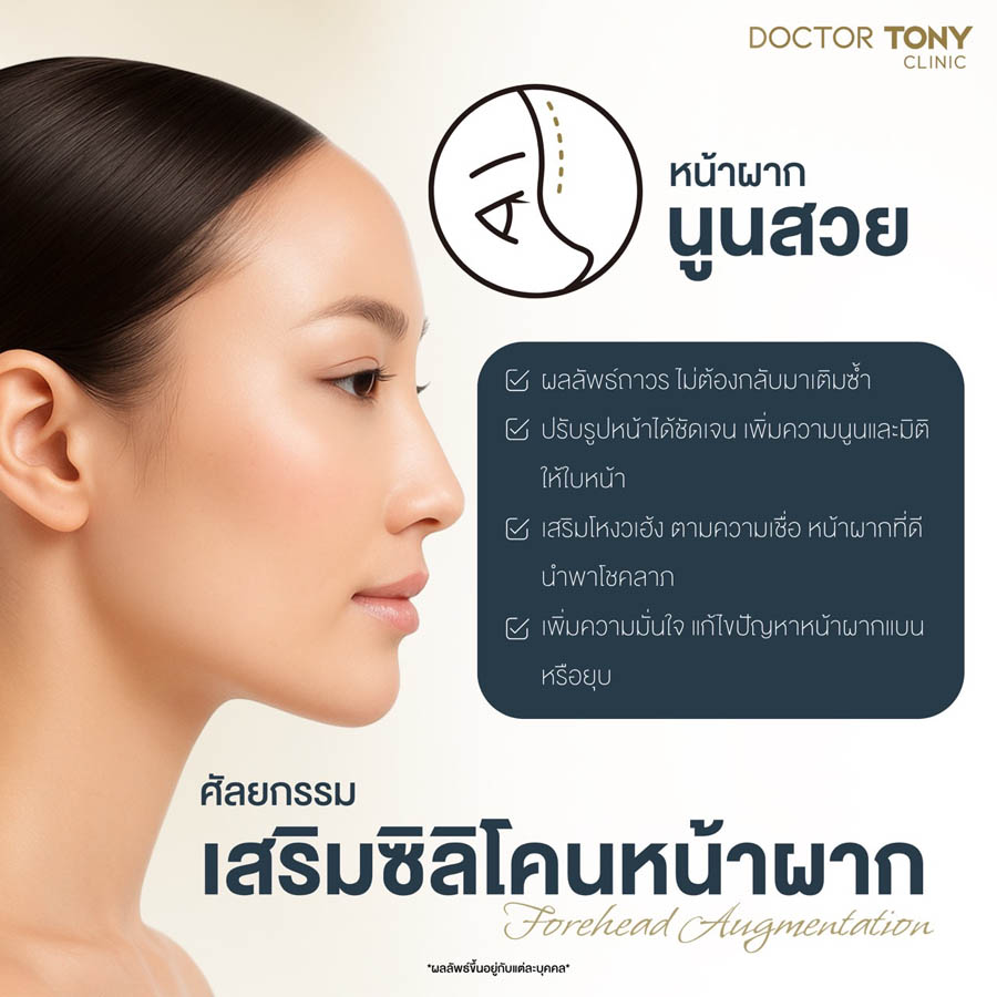 ข้อดี เสริมหน้าผาก