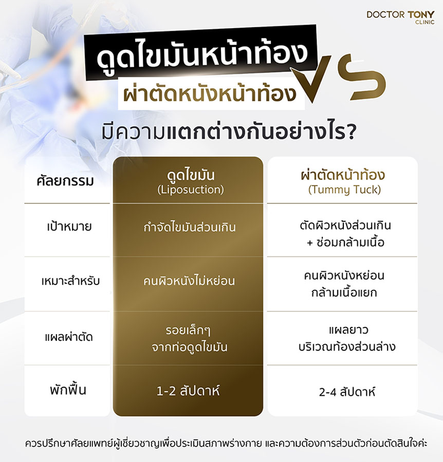 ดูดไขมันหน้าท้อง ผ่าตัดหนังหน้าท้อง
