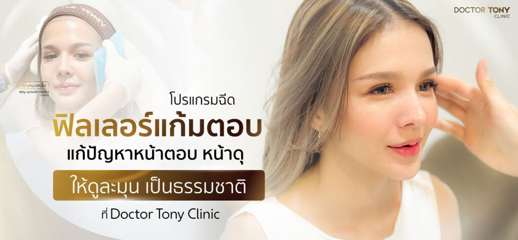 ฟิลเลอร์แก้มตอบ