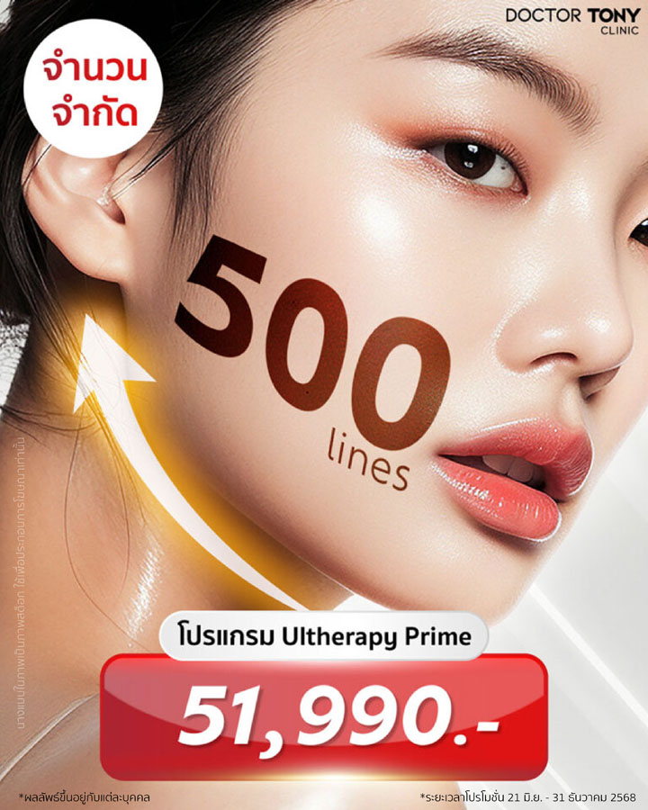 ulthera ราคา