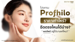 Profhilo ราคา